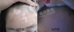 白癜风患者怎么正确使用化妆品